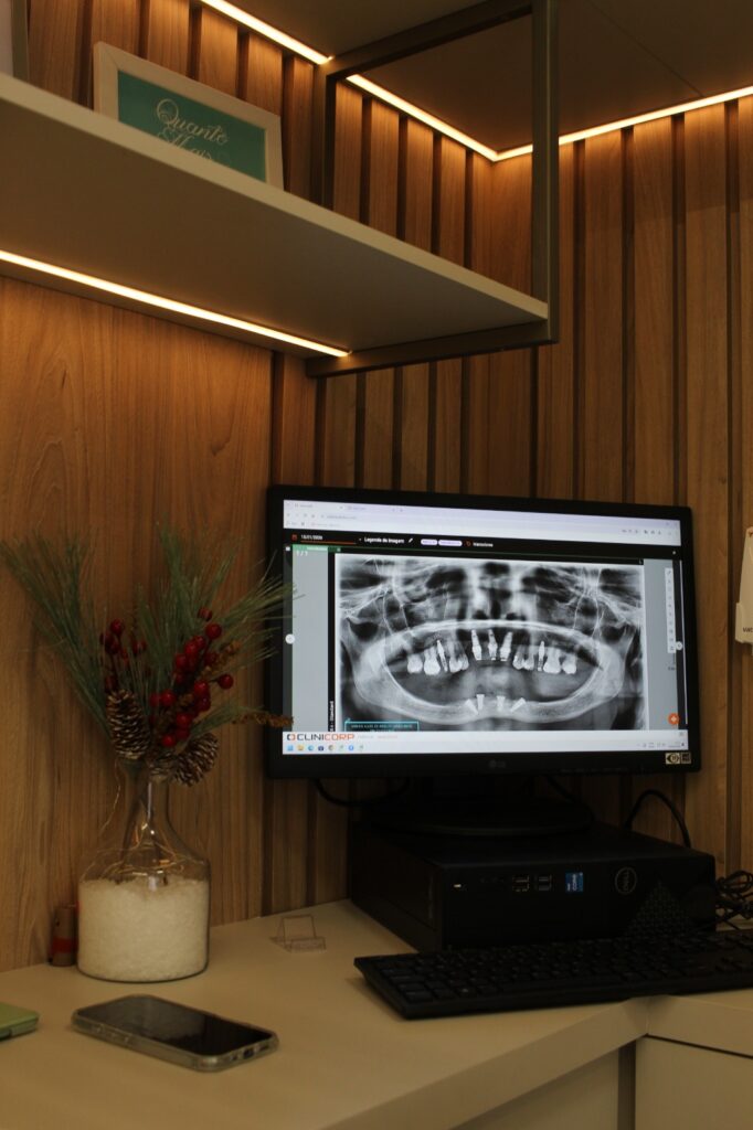 23 - ESTRUTURA - 13.04